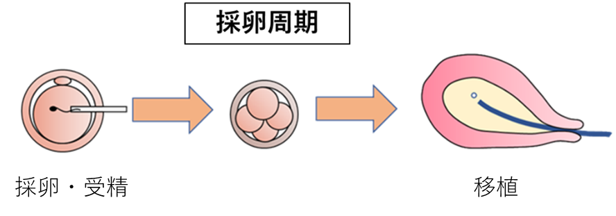 新鮮胚移植の流れの説明の図解。＜採卵周期＞採卵・受精→移植